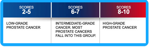 gleason-scores-and-your-life-insurance-lifeinsuranceprostatecancer